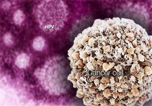如果妻子感染了hpv#,丈夫要怎么办?