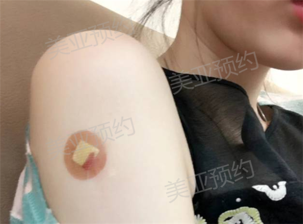 去香港打HPV疫苗